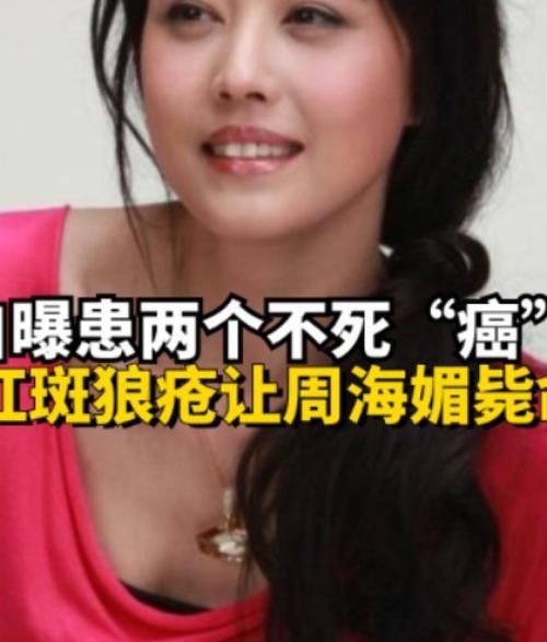 演员周海媚因病去世，困扰她多年的红斑狼疮究竟是种什么病？